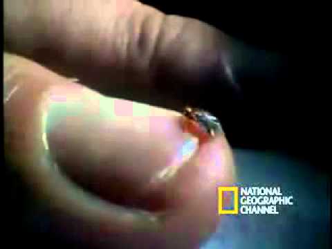 National Geographic Channel Bedbug Documentary.flv