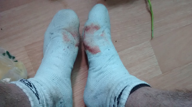 Bloody Socks!